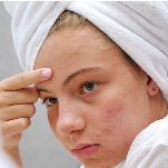 best acne treatment in bangalore​